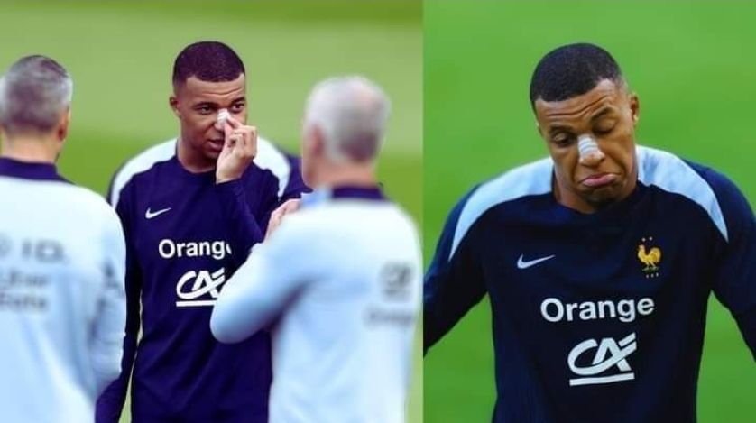 مبابي يعود إلى المنتخب الفرنسي بعد تعرضه لكسر